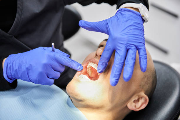 Best Emergency Tooth Extraction in USA